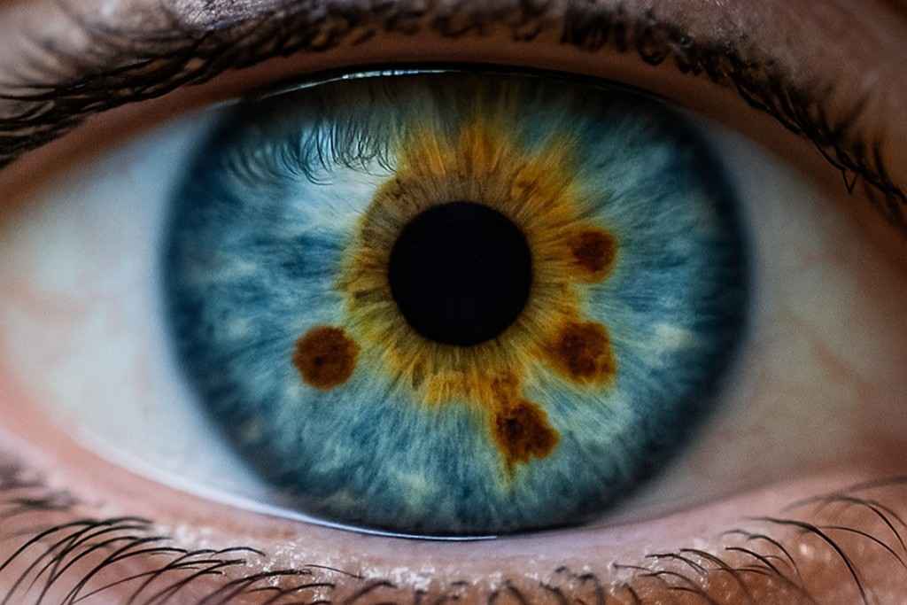 Irisdiagnose in Frankfurt – Individuelle Stoffwechselanalyse für gezielte Gelenktherapie Irisdiagnose zur Erkennung von Stoffwechselbelastungen bei Arthrose und Rheuma